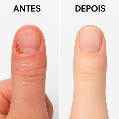 Anel Sol Anti-Stress ajustáveis